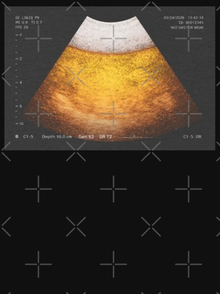 Beer Ultrasound by Soceitiz