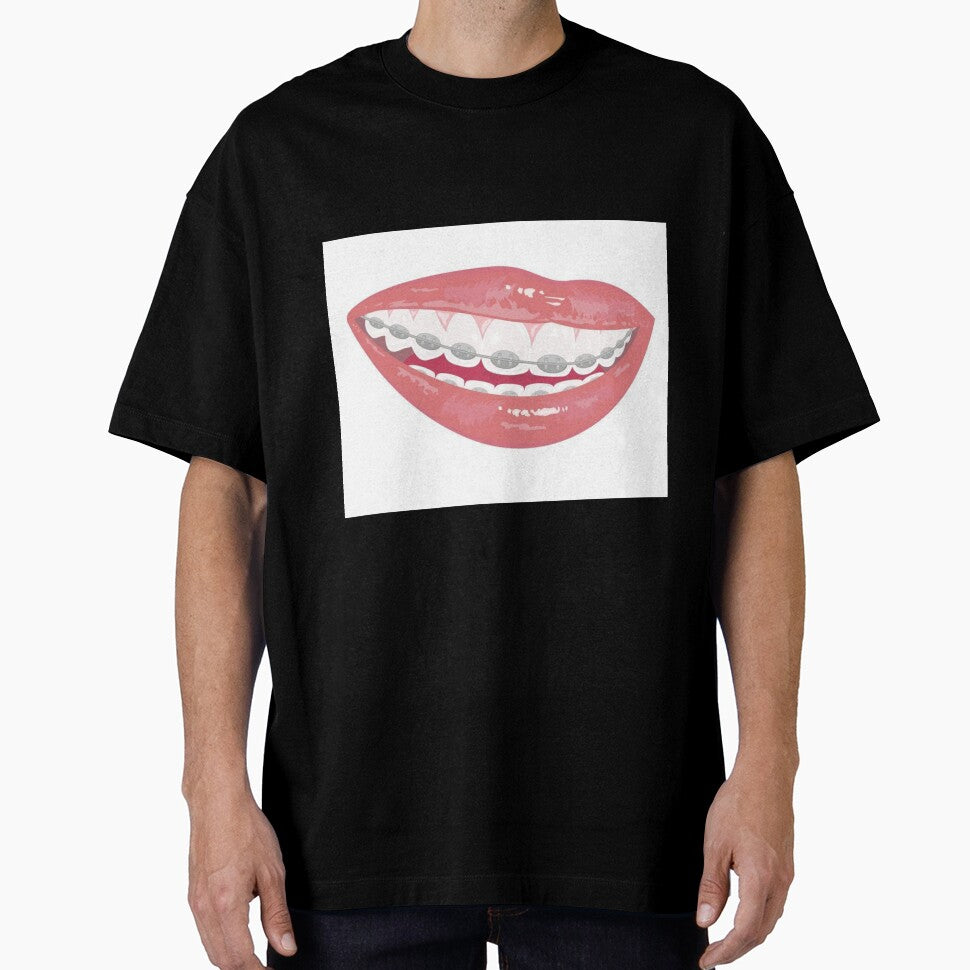 Braces by Sipsta